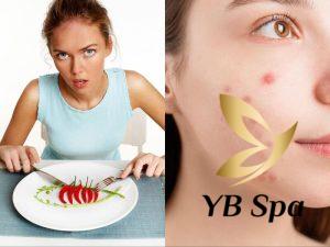 Ăn cay có nổi mụn không? Tại sao ăn cay bị nổi mụn?