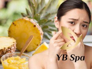 Ăn dứa không gây nổi mụn