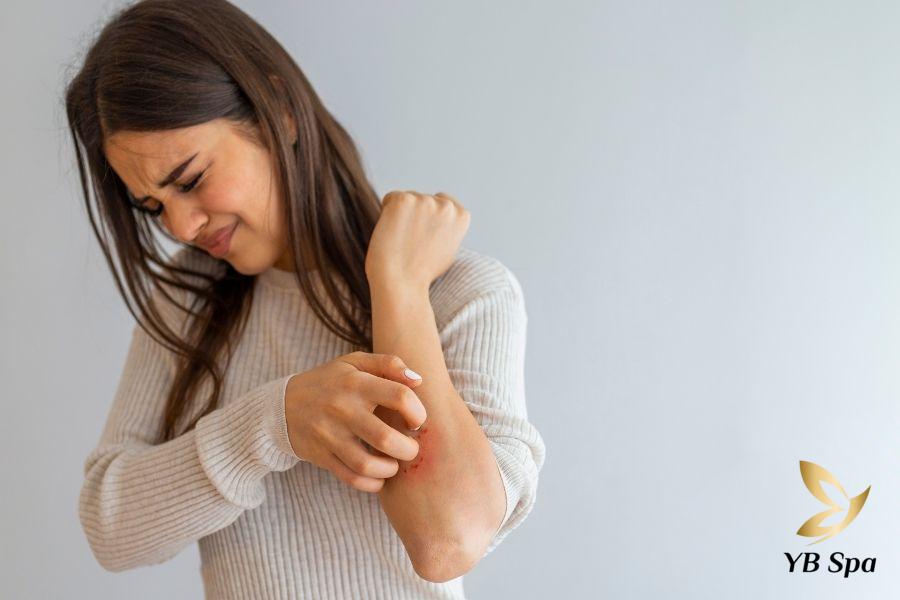Ăn xoài có nổi mụn không? Ăn xoài như nào để không bị mụn 21 Người có cơ địa nóng nên hạn chế xoài
