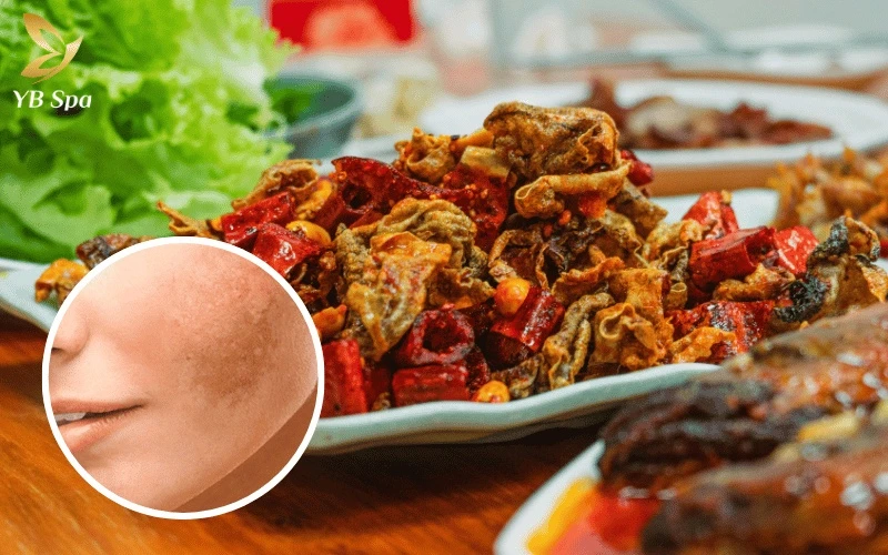 Kiêng đồ cay nóng trong 3–5 ngày đầu giúp làn da tránh được tình trạng đỏ rực, nóng rát và giảm thiểu nguy cơ kích ứng