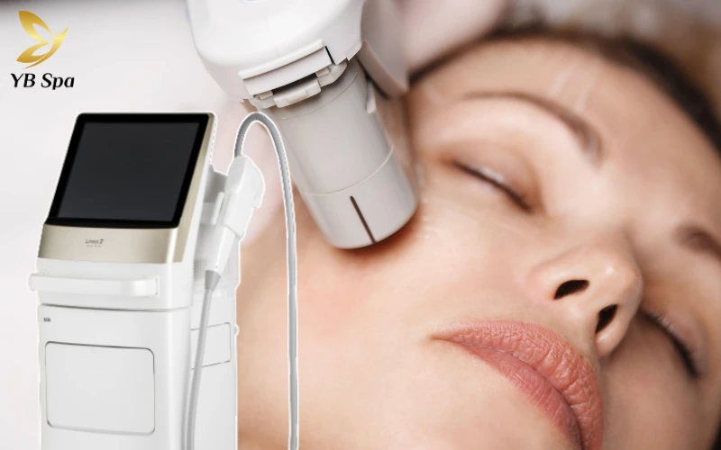 Bắn LinearZ có đau không