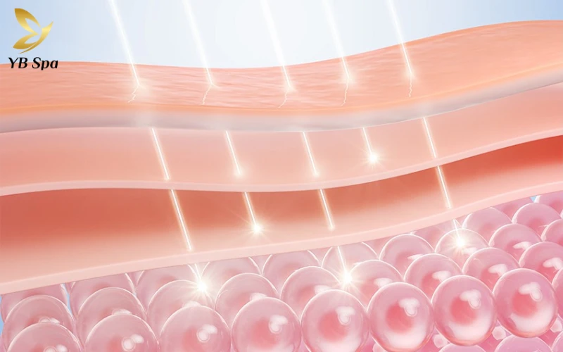 Tìm hiểu về phương pháp bắn tia laser trị nám