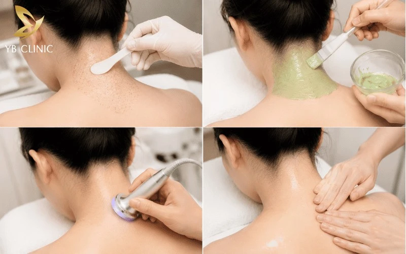 Bảng Giá Triệt Lông Gáy Vĩnh Viễn Mới Nhất 2026 10 Các dịch vụ chăm sóc da đi kèm sau triệt giúp làm dịu, phục hồi vùng gáy, cải thiện bề mặt da sần sùi và hỗ trợ duy trì làn da mịn màng, đều màu hơn.