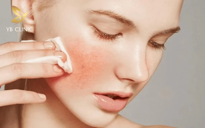 Bao Nhiêu Tuổi Nên Trẻ Hóa Da? Các Phương Pháp Theo Từng Giai Đoạn 14 Việc kết hợp sai cách các hoạt chất mạnh là nguyên nhân hàng đầu khiến da bị viêm và kích ứng.