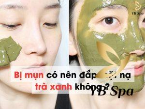 Bị mụn có nên đắp mặt nạ trà xanh không? Khi đắp cần lưu ý gì?