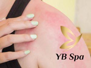 biến chứng khi tiêm meso