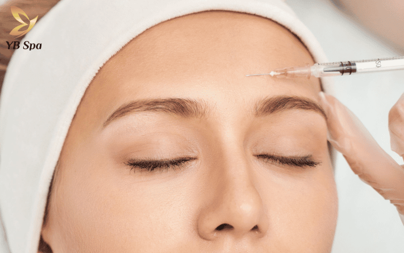 Biến chứng khi tiêm meso là gì? Dấu hiệu nhận biết và cách xử lý kịp thời 31 Việc đưa hoạt chất vào sai lớp trung bì (độ sâu 1mm - 4mm) không chỉ làm lãng phí tinh chất mà còn tiềm ẩn rủi ro gây sần da hoặc tắc mạch nguy hiểm