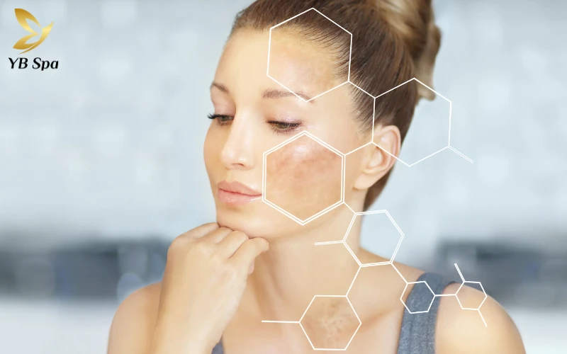 Tầm quan trọng của việc trị nám từ bên trong