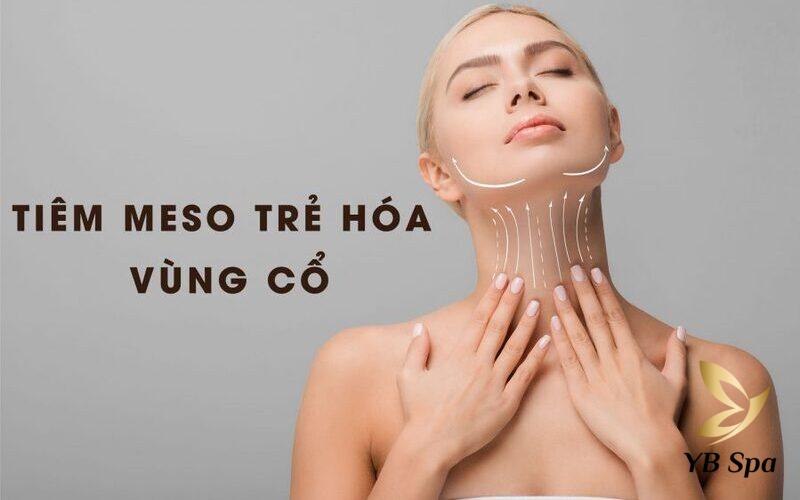 Các phương pháp tiêm meso hiệu quả nhất 2025 14 Vùng cổ giảm nếp nhăn sau khi tiêm meso