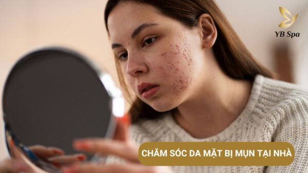 Cach Cham Soc Da Mat Bi Mun 1