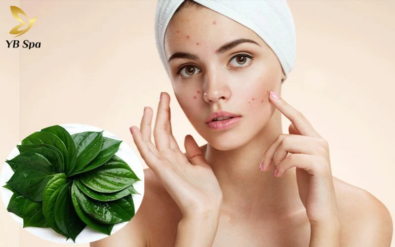 Cách chữa mụn nhọt sưng to an toàn, hiệu quả 29 lá trầu trị mụn