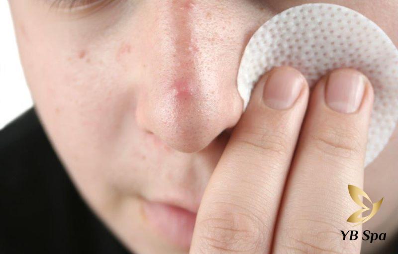 Mụn nhọt ở trên mũi