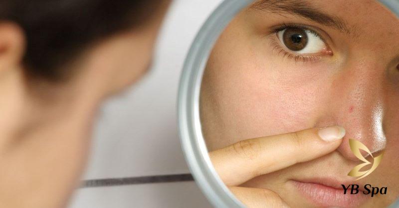 Nặn mụn nhọt ở vị trí mũi