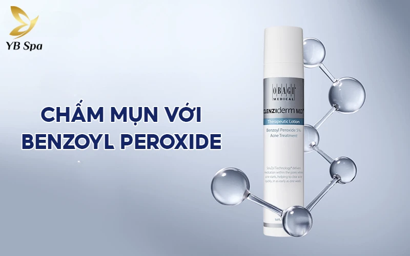 15+ Cách trị mụn ẩn tuổi dậy thì hiệu quả, chuẩn y khoa giúp da láng mịn 14 Ngăn chặn sự tấn công của vi khuẩn gây mụn bằng cách chấm Benzoyl Peroxide ngay khi nhân mụn ẩn có dấu hiệu sưng nhẹ.