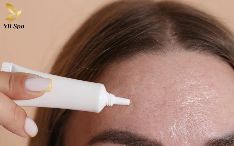 6 cách trị mụn bọc cho da nhờn, giảm sưng trong 24 giờ 12 Hãy ưu tiên nồng độ 2.5% hoặc 5% để "diệt" mụn hiệu quả mà vẫn đảm bảo làn da nhờn không bị kích ứng hay cháy bề mặt.