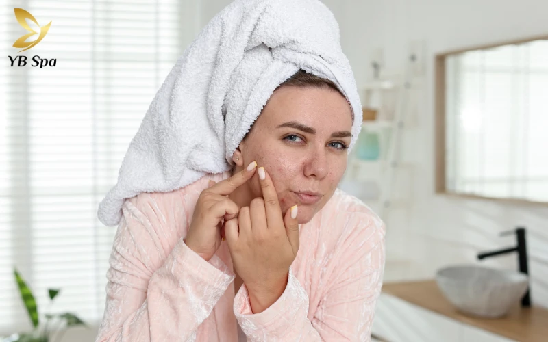 6 cách trị mụn bọc cho da nhờn, giảm sưng trong 24 giờ 18 Tự ý "ép" nốt mụn bọc khi còn sưng cứng là cách nhanh nhất để phá hủy cấu trúc da và để lại những vết sẹo rỗ vĩnh viễn.