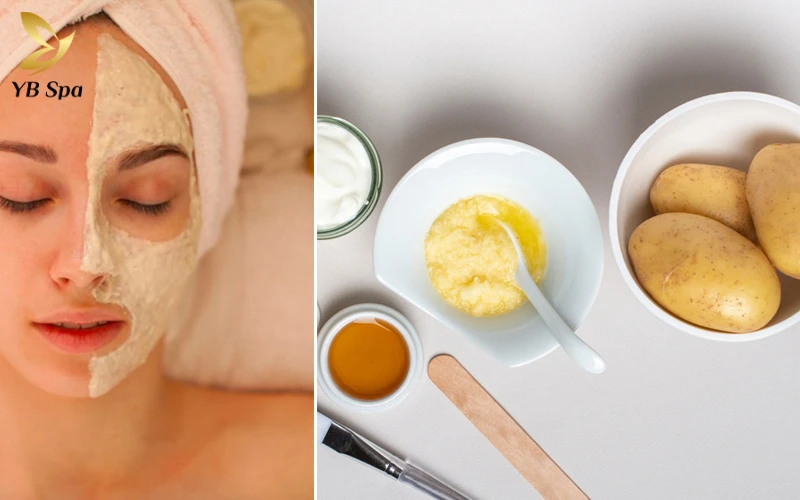 16+ Cách trị mụn bọc ở cằm tại nhà hiệu quả từ thiên nhiên 20 Sử dụng khoai tây để xử lý mụn bọc là phương pháp tự nhiên giúp gom cồi mụn hiệu quả đồng thời làm sáng vùng da quanh cằm