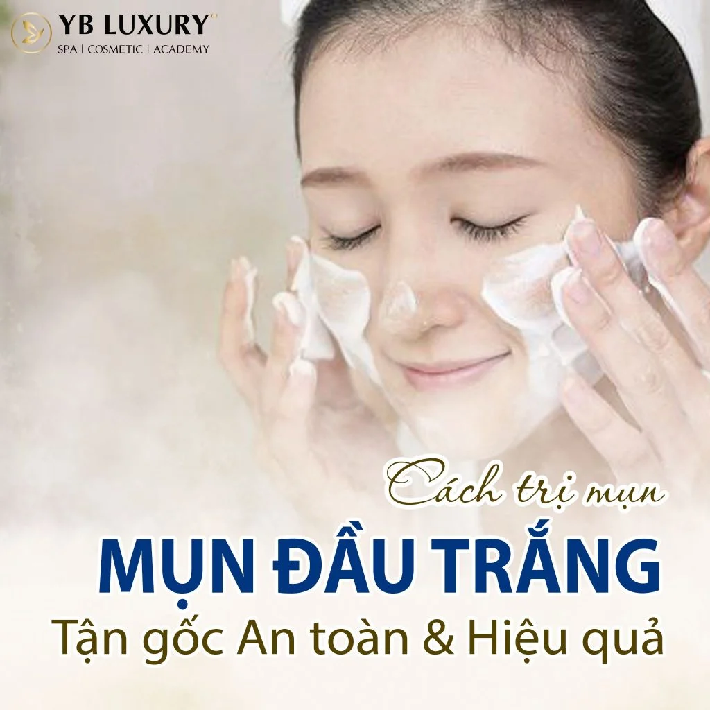 4. Các Thành Phần Hiệu Quả Trong Trị Mụn Đầu Trắng