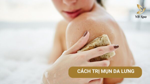 Cách trị mụn lưng hiệu quả sau 7 ngày  25 Cach Tri Mun Lung