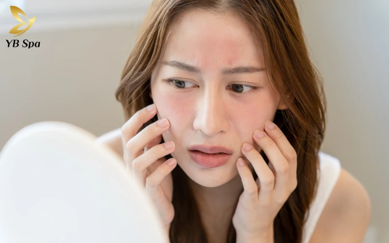 sai lầm cần tránh khi trị mụn thịt quanh mắt: Tự ý nặn hoặc cạy mụn thịt