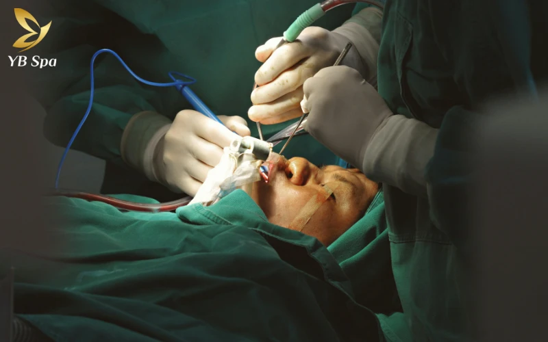 Cách trị sẹo lồi trên mặt hiệu quả từ thiên nhiên đến công nghệ cao 37 Phẫu thuật cắt bỏ sẹo lồi