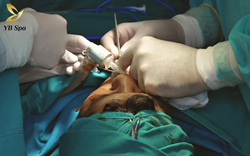 Cách trị sẹo lồi trên mặt hiệu quả từ thiên nhiên đến công nghệ cao 28 Chấn thương da và tai nạn sinh hoạt