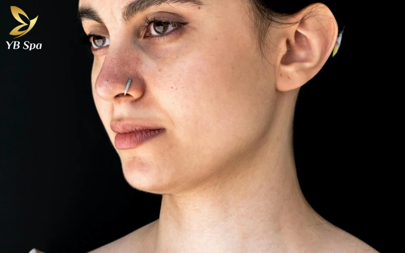 Cách trị sẹo lồi trên mặt hiệu quả từ thiên nhiên đến công nghệ cao 29 Thẩm mỹ xâm lấn và xỏ khuyên