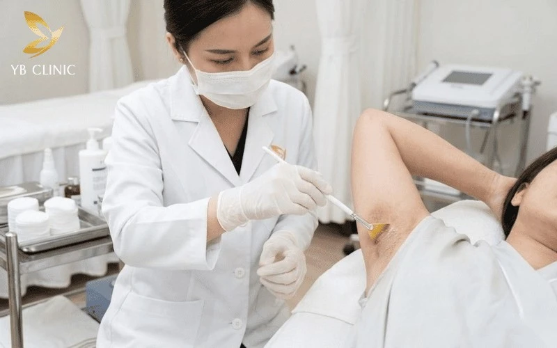 8 Cách Trị Thâm Nách Hiệu Quả Và An Toàn 9 Peel da trị thâm nách giúp thúc đẩy quá trình thay da, mang lại vùng da dưới cánh tay mịn màng hơn.