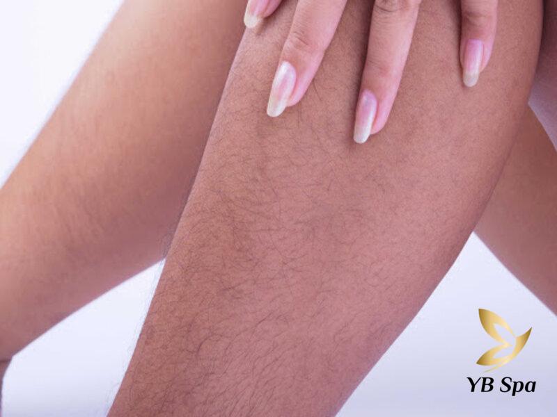 Cách Triệt Lông Chân Vĩnh Viễn Tại Nhà Cho Nữ Dễ Dàng Thực Hiện 25 Lông chân dài, rậm có thể do di truyền và nhiều nguyên nhân khác (Nguồn: Internet)