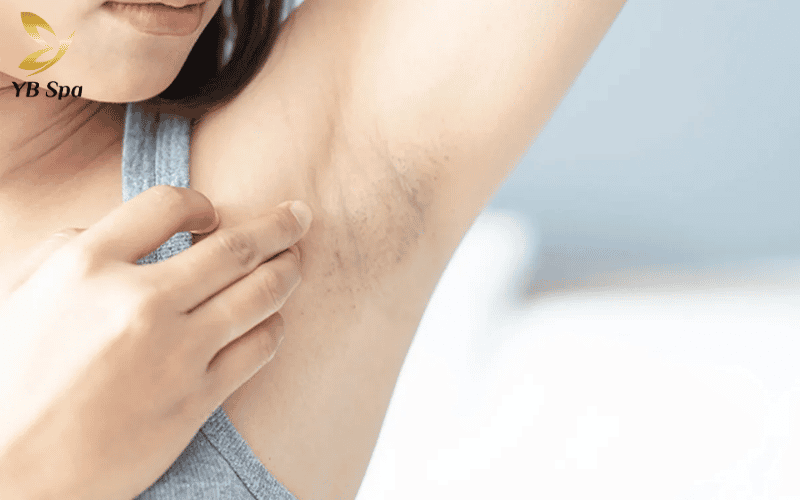 Sự trỗi dậy của hormone androgen chính là "chìa khóa" giải thích tốc độ phát triển thần tốc của lông nách ở lứa tuổi dậy thì