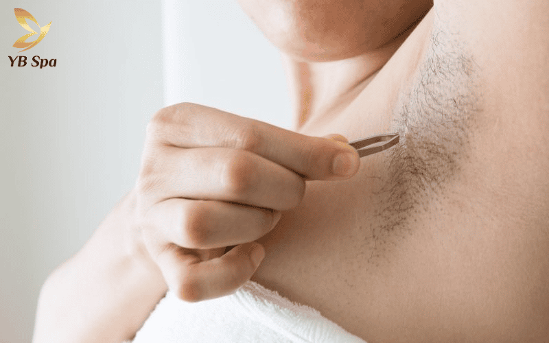 Nhíp chỉ nên là phương án tạm thời cho vài sợi đơn lẻ để bảo vệ vùng da dưới cánh tay khỏi viêm nang lông