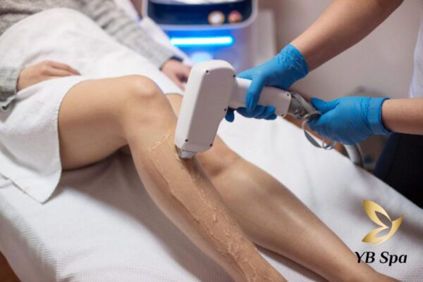 Cách Triệt Lông Vĩnh Viễn Không Mọc Lại? Spa Triệt lông Vĩnh Viễn 18 cach triet long vinh vien khong moc lai 7