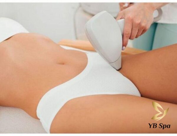 Phương pháp triệt lông bằng laser (Nguồn: Internet)