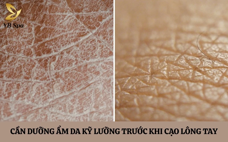 Cạo lông tay có sao không? Có mọc dày hơn không? 13 Nếu làn da đang có dấu hiệu thiếu ẩm trầm trọng, hãy ưu tiên quy trình phục hồi và dưỡng ẩm trước khi nghĩ đến việc sử dụng dao cạo