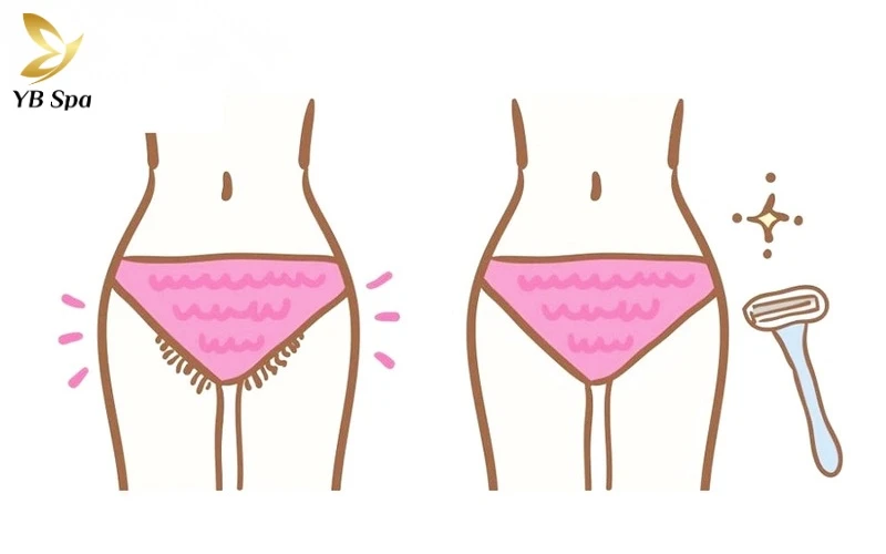 Tạm biệt nỗi lo ngứa rát với quy trình 4 bước cạo lông vùng kín chuẩn y khoa cực đơn giản