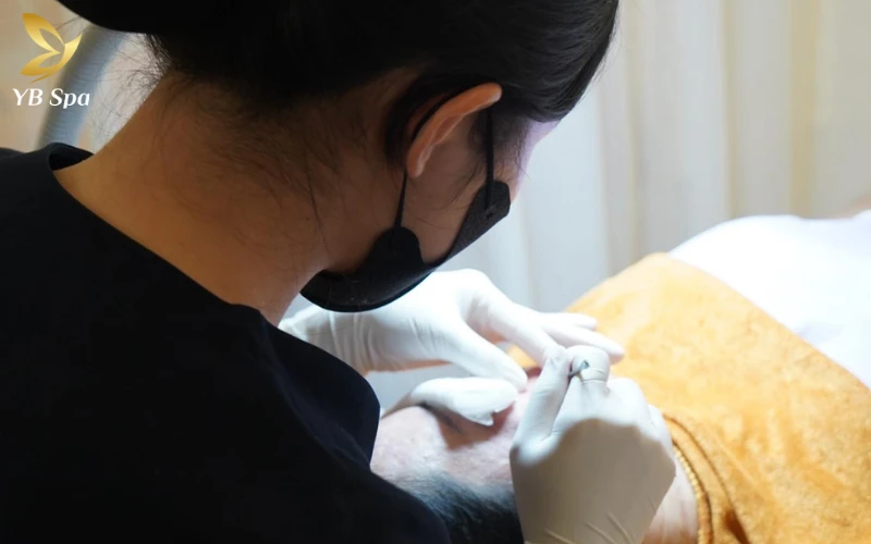 Quy trình 6 bước chăm sóc da mặt tại Spa chuẩn y khoa 13 Kỹ thuật lấy nhân mụn khéo léo giúp dọn sạch ổ viêm mà không gây sưng nề, đau rát hay tổn thương cấu trúc da