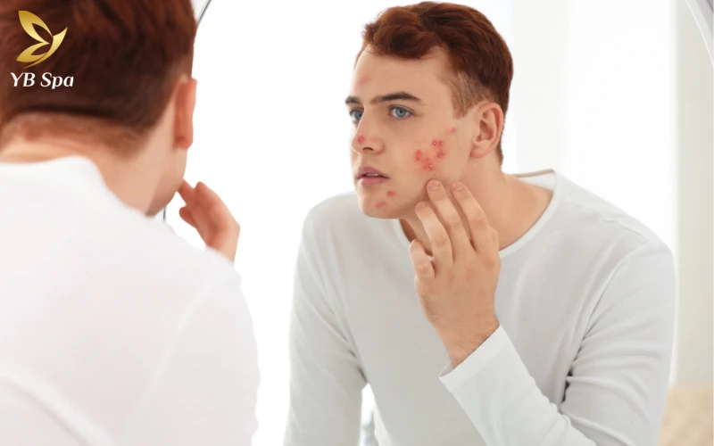 Quy trình 6 bước chăm sóc da mặt tại Spa chuẩn y khoa 16 Tuyệt đối không chạm tay lên mặt sau khi lấy mụn để bảo vệ làn da khỏi vi khuẩn xâm nhập và ngăn ngừa viêm nhiễm