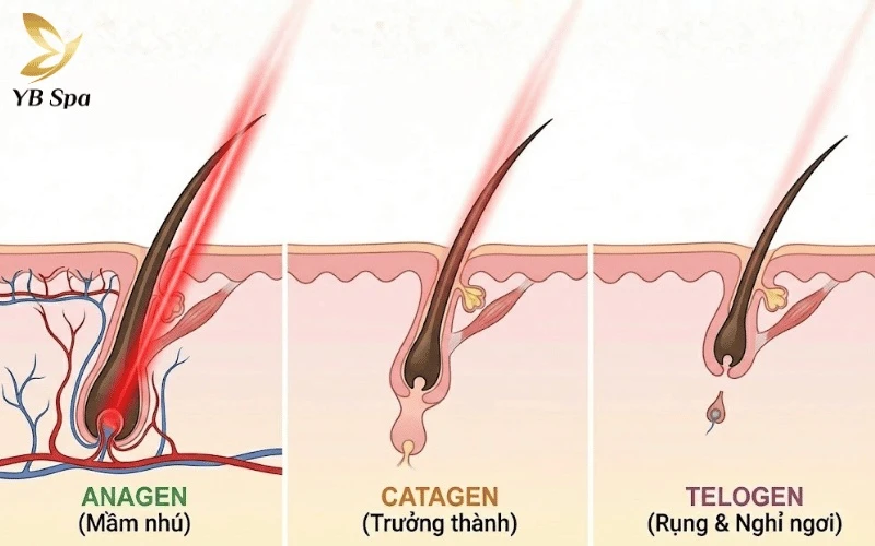 Chu kỳ phát triển của sợi lông: 3 giai đoạn mọc – nghỉ – rụng và cơ chế tái sinh 29 Tia Laser chỉ có thể tiêu diệt tận gốc nhú chân lông khi sợi lông đang ở giai đoạn Anagen và kết nối trực tiếp với nguồn dinh dưỡng