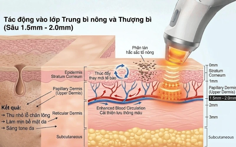 Năng lượng nhiệt ở độ sâu 1.5mm thúc đẩy quá trình thay mới tế bào, mang lại làn da láng mịn và tươi trẻ