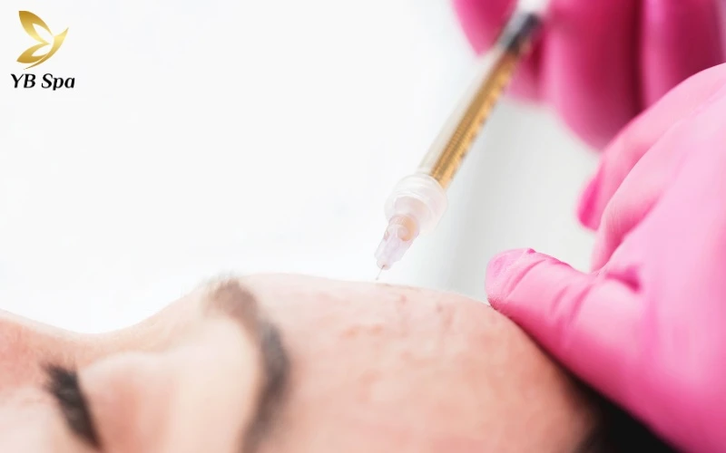 Mesotherapy cung cấp các hoạt chất điều trị ngay tại vùng da hư tổn, giúp đẩy nhanh quá trình tái tạo tế bào gấp nhiều lần so với bôi thoa thông thường