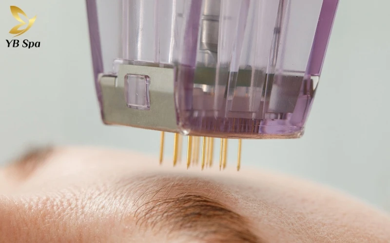 Cơ chế phục hồi da của Mesotherapy hoạt động như thế nào? 13 Meso sử dụng các đầu kim siêu nhỏ để "tiếp tế" vitamin và HA trực tiếp đến tầng trung bì – nơi các sợi collagen và mạch máu khu trú