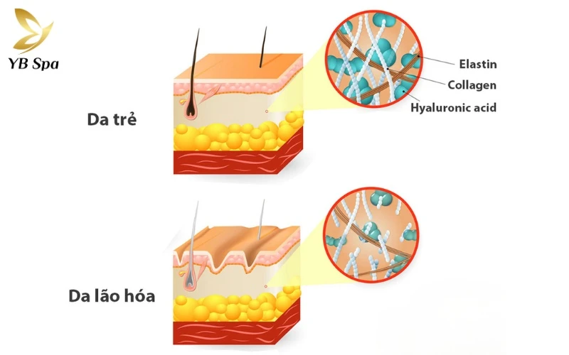 Cơ chế phục hồi da của Mesotherapy hoạt động như thế nào? 15 Mesotherapy thúc đẩy quá trình Neocollagenesis, giúp tăng sinh Collagen Type I, III và Elastin để tái cấu trúc khung nâng đỡ của da