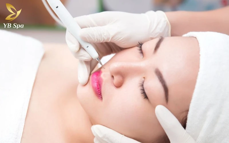 Có nên đốt mụn thịt không? Giải đáp chi tiết từ chuyên gia 24 chăm sóc da