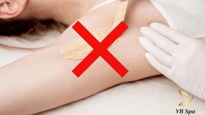 Có Nên Triệt Lông Bikini Không? Những Lợi Ích Và Rủi Ro Cần Lưu Ý 15 Tuyệt đối không wax hoặc nhổ lông trước khi triệt để tránh làm tổn thương nang lông