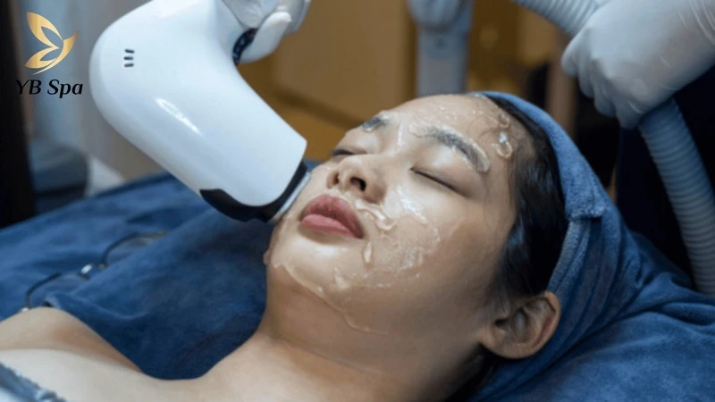 Có Nên Triệt Lông Mặt Không? Lợi Ích Và Những Rủi Ro Cần Lưu Ý 15 Diode Laser là giải pháp triệt lông mặt tận gốc, mang lại hiệu quả lâu dài và an toàn
