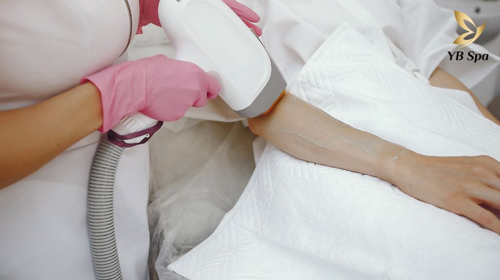 dịch vụ triệt lông 