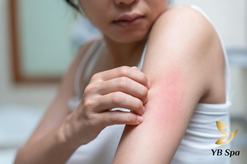 Có nên triệt lông tay không? Phương pháp triệt lông tay hiệu quả 20 Triệt lông tay không đúng cách có thể gây kích ứng