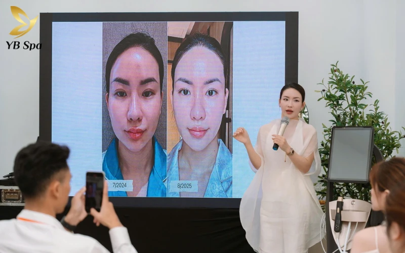 Không chỉ đẹp tức thì, Density RF thúc đẩy quá trình tăng sinh Collagen dồn dập suốt 3-6 tháng để da ngày càng săn chắc theo thời gian