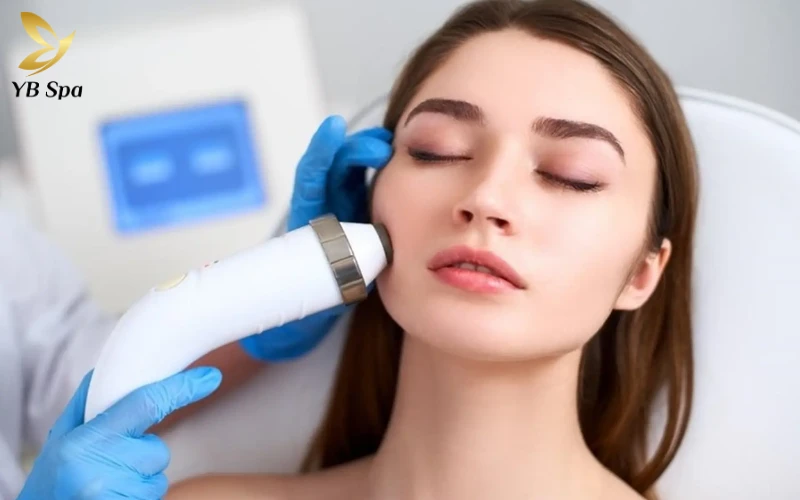 Top 7 Công nghệ trị sẹo rỗ tốt hàng đầu hiện nay 27 Công Nghệ RF (Radio Frequency) Vi Kim