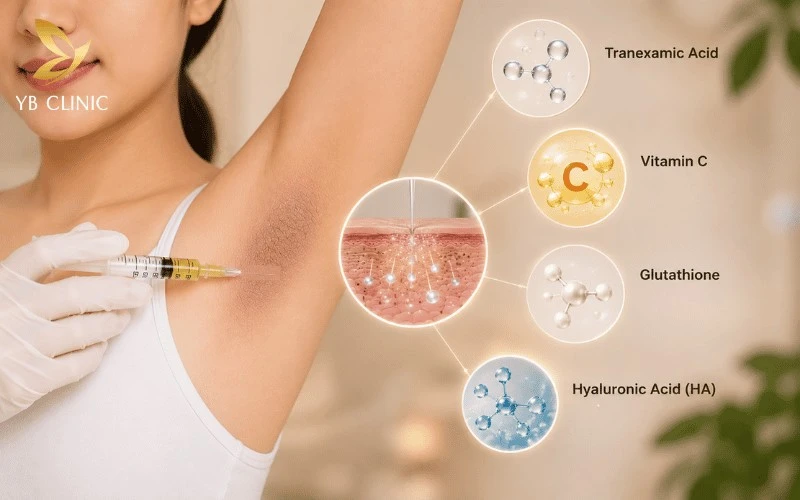 Top 5 Công Nghệ Trị Thâm Nách Phổ Biến Hiện Nay 9 Mesotherapy trị thâm nách sử dụng nhiều hoạt chất làm sáng da và phục hồi như Vitamin C, Tranexamic Acid, Glutathione cùng Hyaluronic Acid để cải thiện sắc tố và độ ẩm của da.